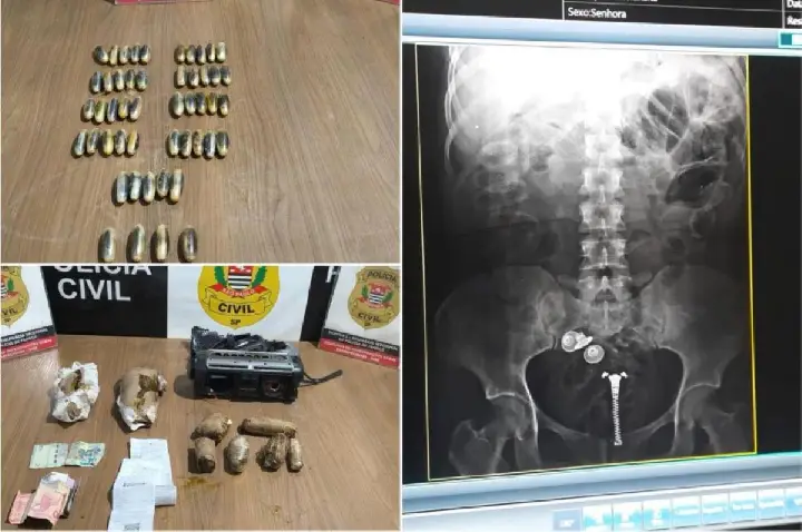 Boliviana é presa transportando droga no estômago rumo a Franca