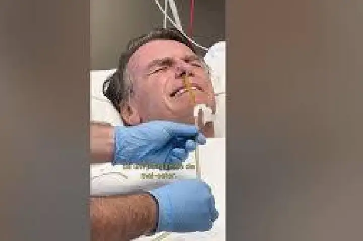 Bolsonaro choca ao publicar retirada da sonda nasogástrica; VÍDEO