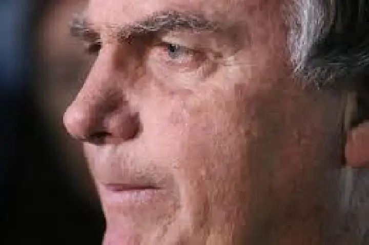 Bolsonaro passa por nova cirurgia após voltar a ter soluços