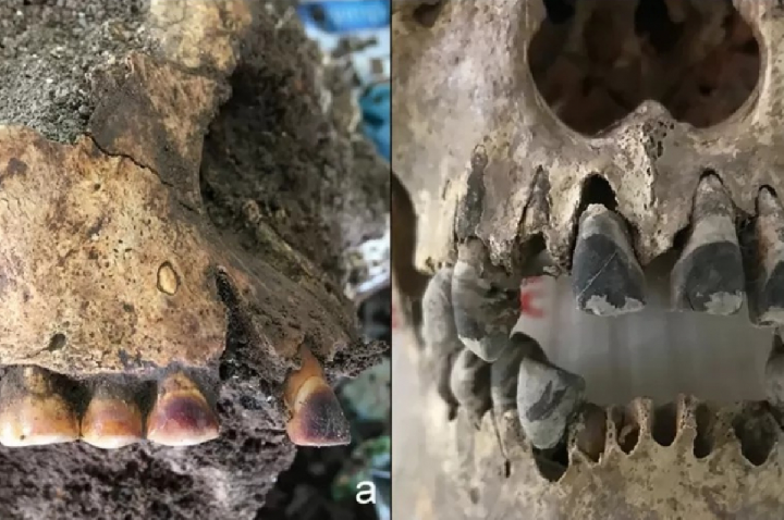 Cientistas acham crânios de 2.000 anos, e dentes chamam atenção