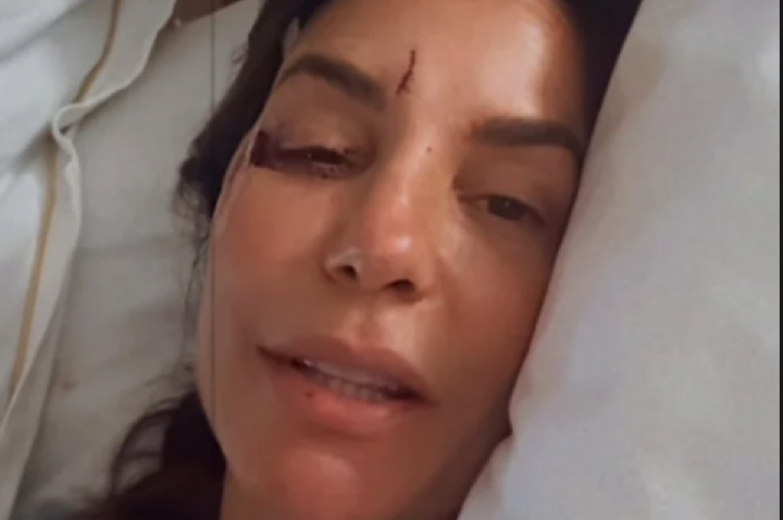 Cirurgia de 7 horas em Ivete Sangalo é considerada delicada