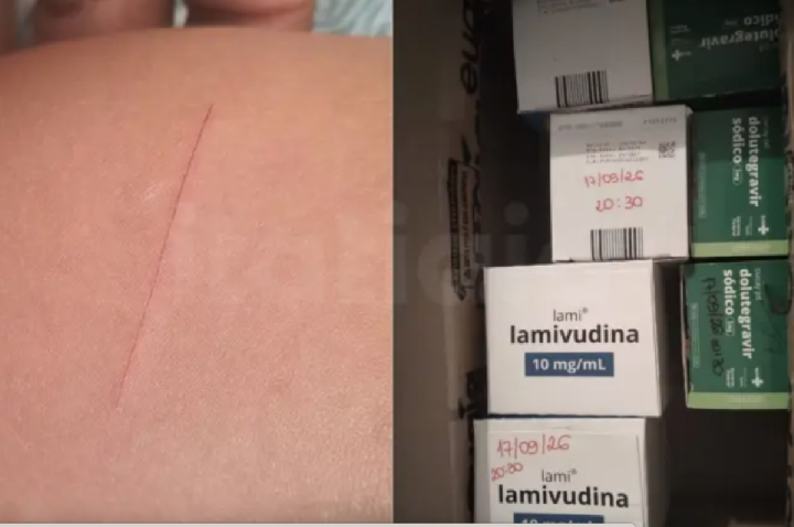 Criança inicia tratamento contra HIV após ser cortada por colega