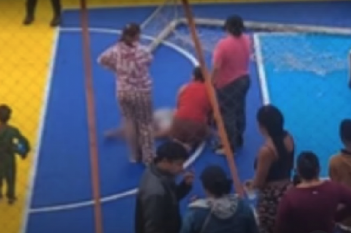 Criança vai para a UTI após ser atingida por trave