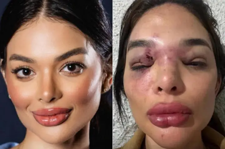 Dentista diz que vizinhos a acolheram após fugir do marido
