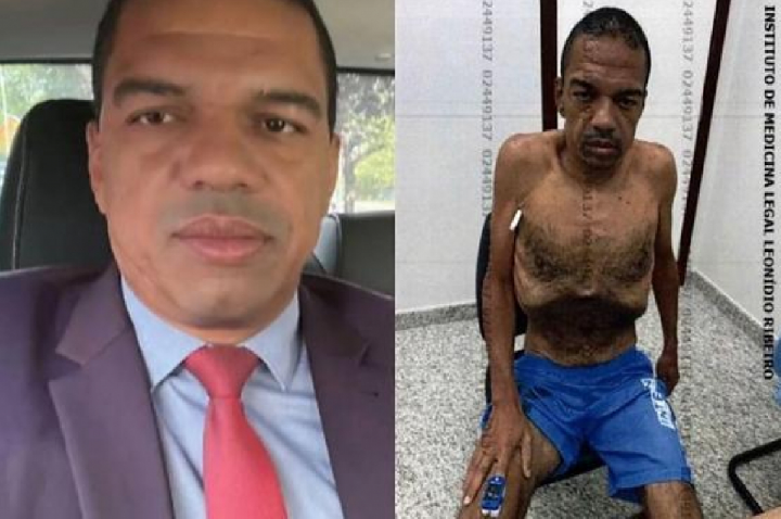 Emagrecimento de lobista gera apuração e vai parar no STF