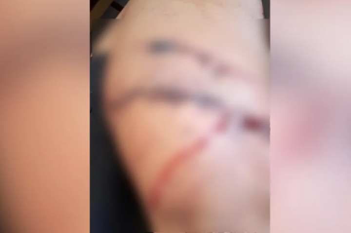 Gestante é ferida com caco de vidro pela namorada do ex