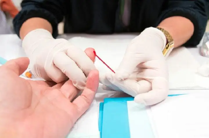 HIV/AIDS segue como desafio de saúde pública no Brasil, com maior prevalência entre homens