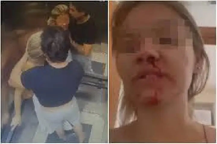 Homem bate na namorada, limpa sangue na camisa e a beija; VÍDEO
