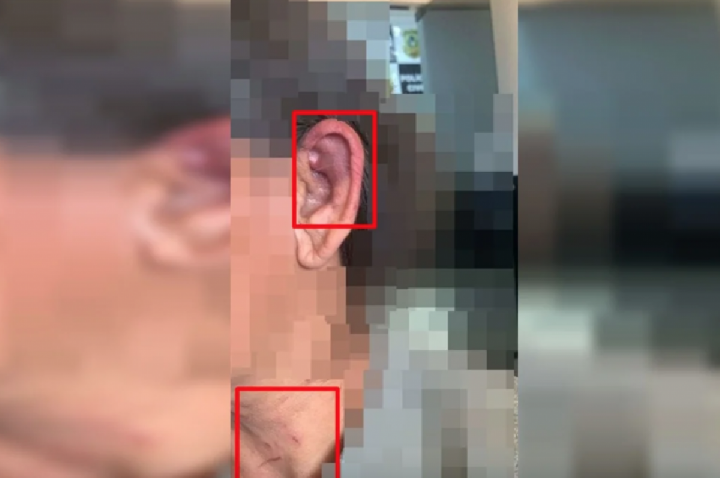 Homem estrangula mãe de amigo com toalha