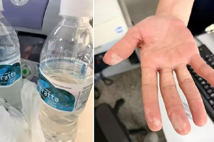 Laudo aponta presença de ácido na garrafa de água consumida por homem internado com sintomas de intoxicação