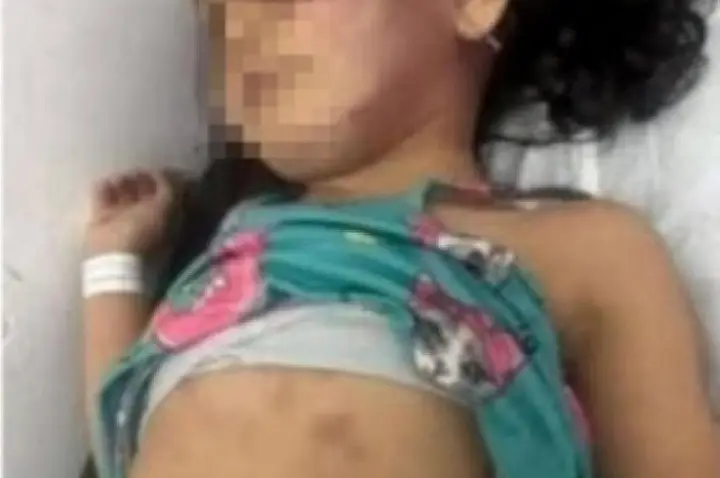 Mãe e padrasto são suspeitos de torturarem menina de 3 anos
