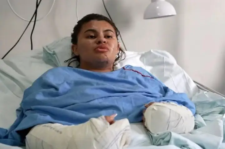 'Me fiz de morta', diz estudante que teve as mãos amputadas