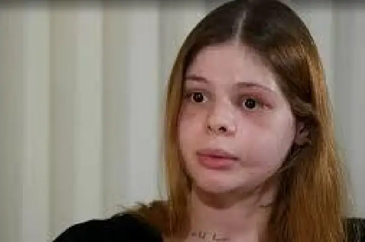 Médica agredida por ex-namorado ficou com rosto 'destruído'