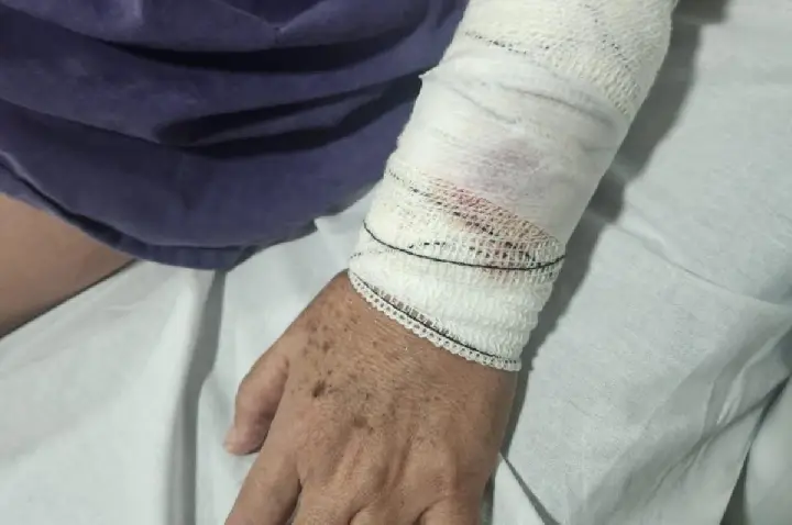 Mulher é baleada durante carreata na Nações Unidas, em Bauru