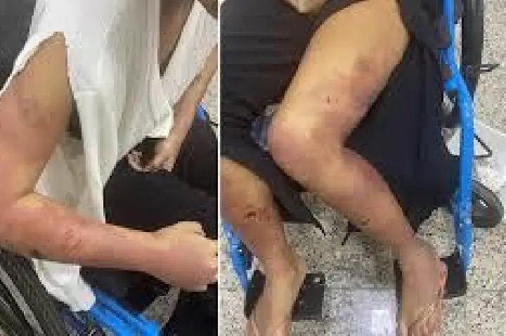 Mulher é sequestrada e torturada por namorado