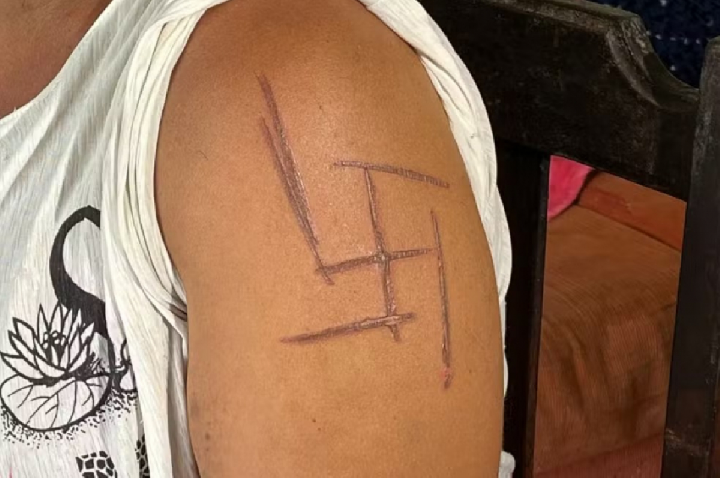 Mulher é torturada e tem suástica marcada na pele; patrões presos