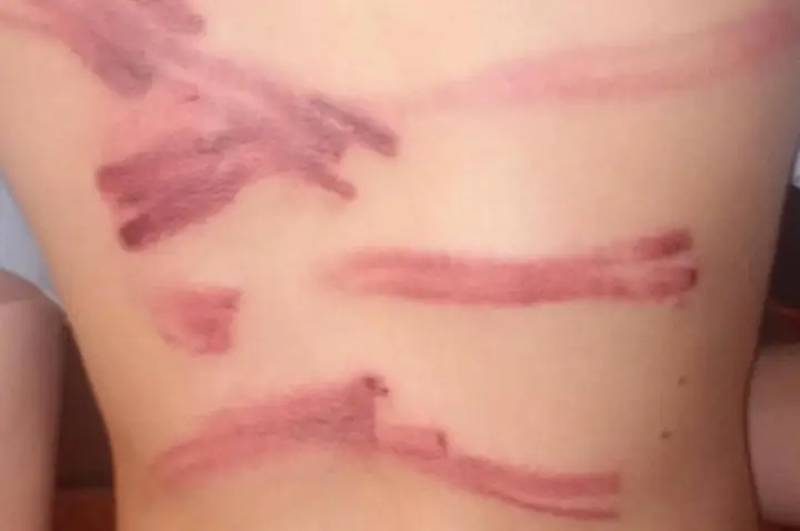 Pai é preso após agredir filho de 13 anos com mangueira em Bariri