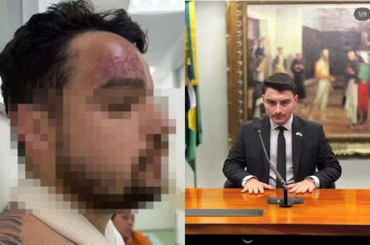 Polícia investiga assessor de Jair Renan após agredir primo