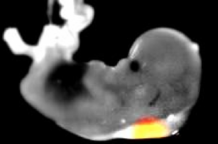 Projeto obriga mulher a ouvir batimentos de feto antes de aborto