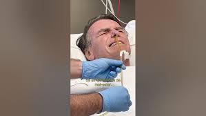 Bolsonaro choca ao publicar retirada da sonda nasogástrica; VÍDEO