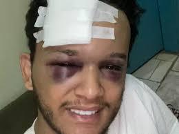 Sertanejo sofre traumatismo craniano ao voltar de show; VÍDEO