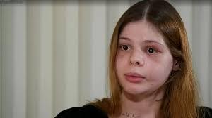 Médica agredida por ex-namorado ficou com rosto 'destruído'