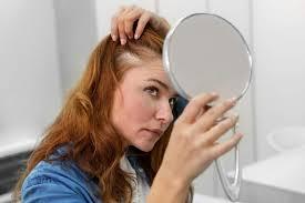 Queda de cabelo feminina: entenda causas e tratamentos