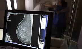 SUS garante mamografia para mulheres a partir dos 40 anos