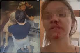 Homem bate na namorada, limpa sangue na camisa e a beija; VÍDEO