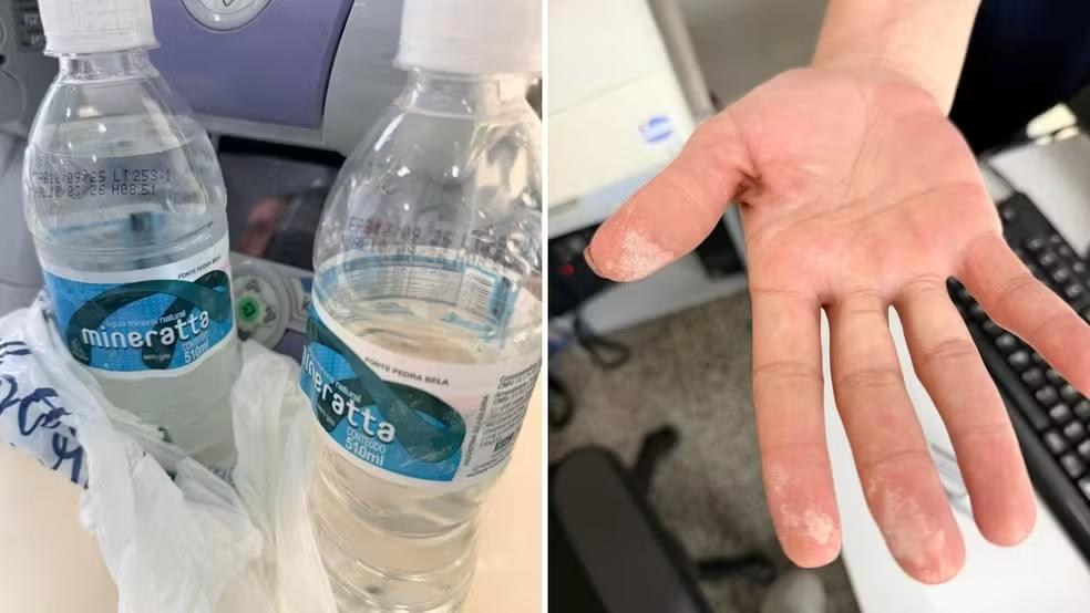 Laudo aponta presença de ácido na garrafa de água consumida por homem internado com sintomas de intoxicação