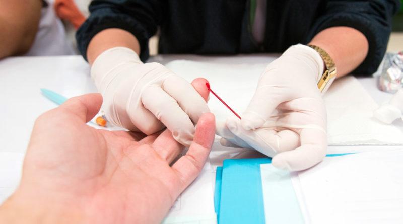 HIV/AIDS segue como desafio de saúde pública no Brasil, com maior prevalência entre homens