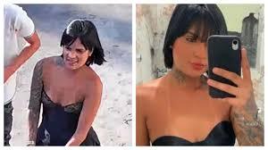 Vítima arrastada na Marginal Tietê faz nova amputação; VÍDEO