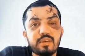 ‘Corrida da morte’: motoristas fazem campanha por colega de Bauru