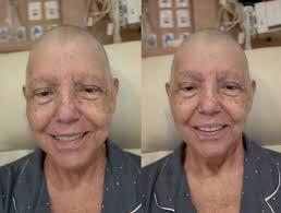 Em tratamento contra câncer, Roseana Sarney tem pneumonia