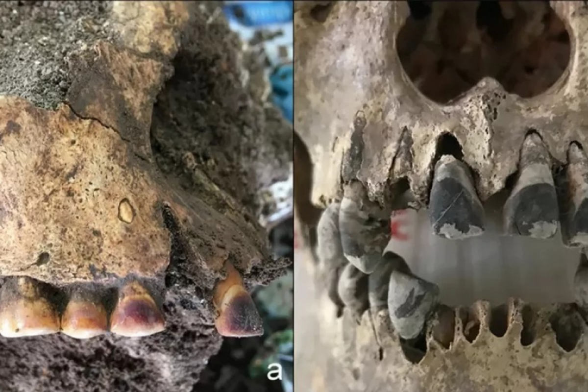Cientistas acham crânios de 2.000 anos, e dentes chamam atenção