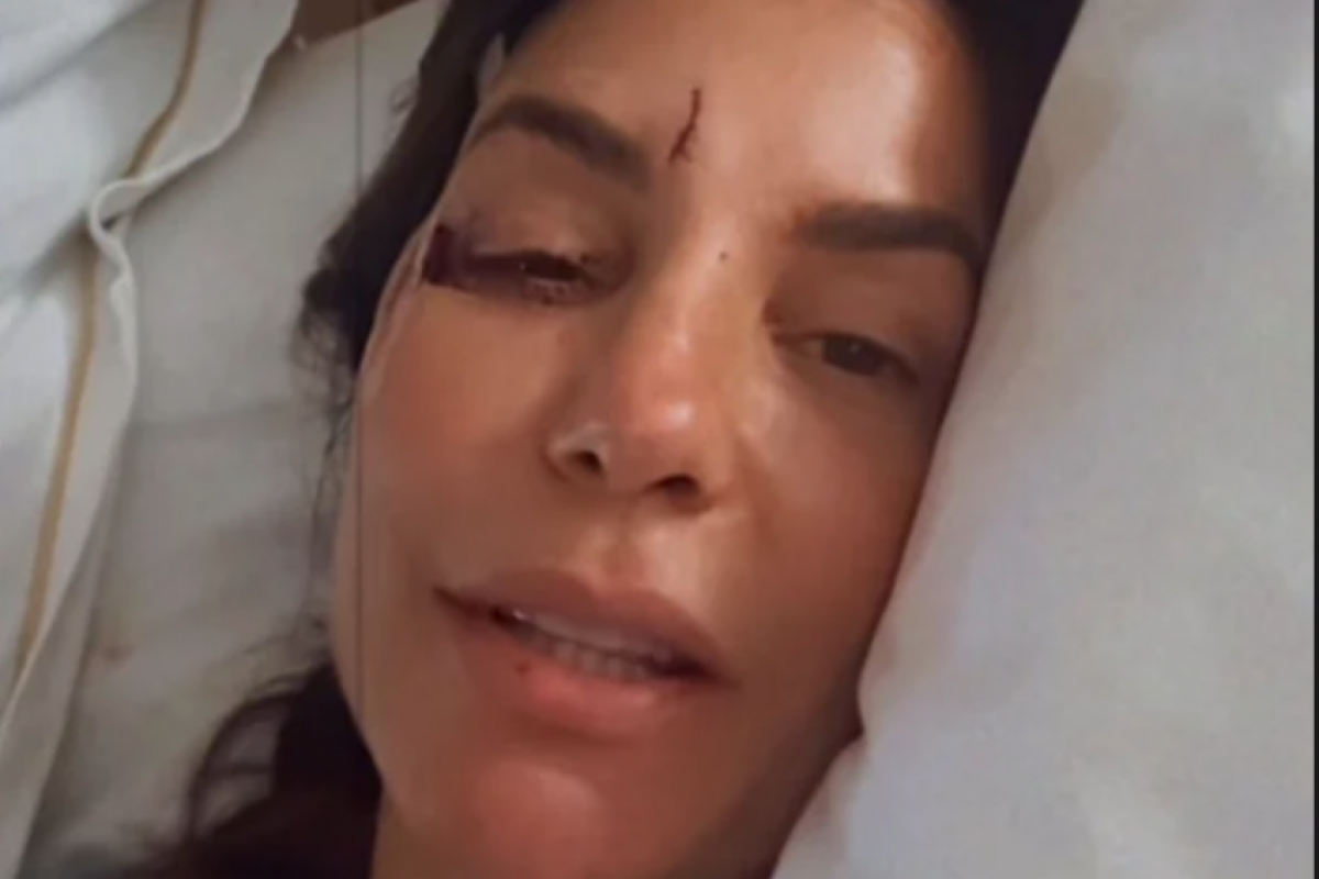 Cirurgia de 7 horas em Ivete Sangalo é considerada delicada