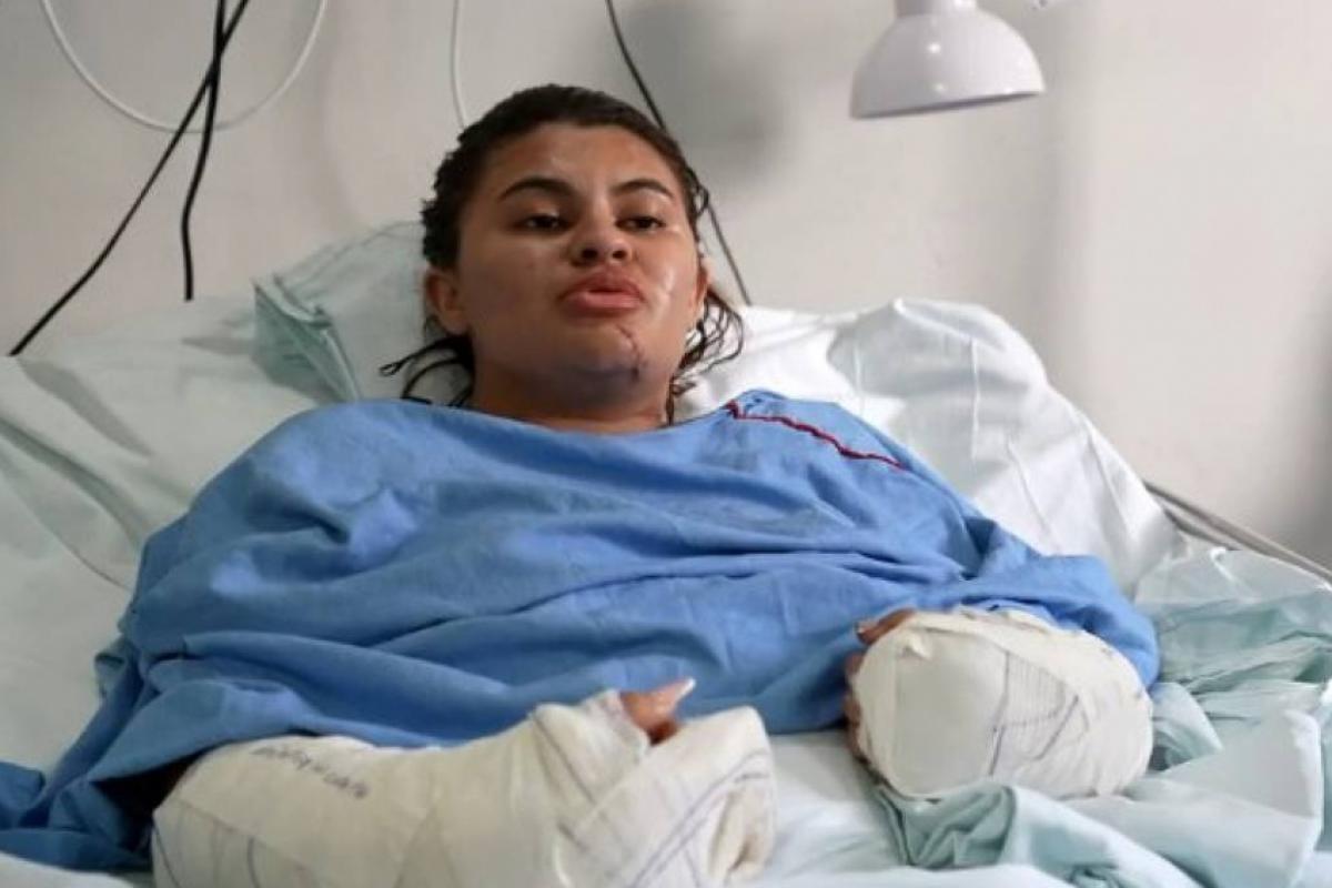 'Me fiz de morta', diz estudante que teve as mãos amputadas