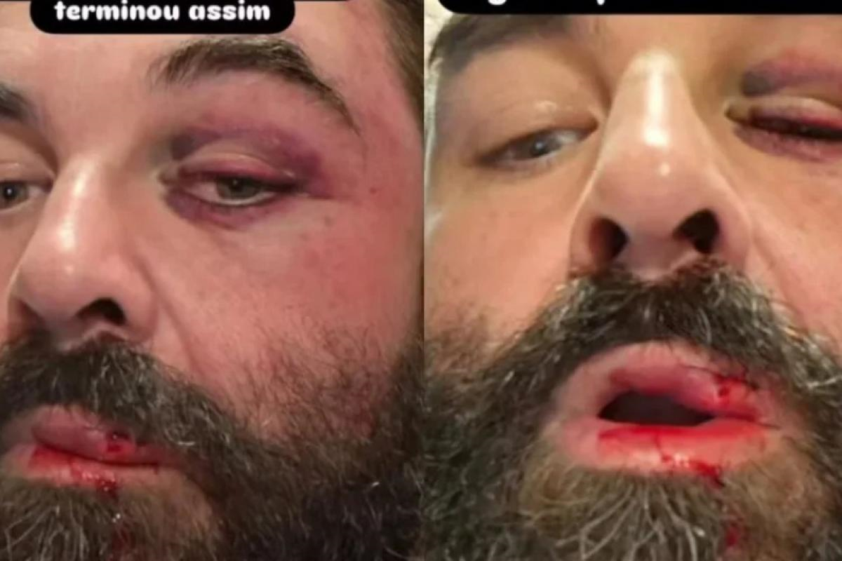 Pai de criança autista é agredido após reclamar de som em igreja