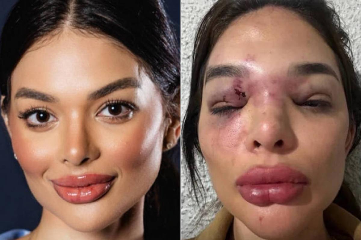 Dentista diz que vizinhos a acolheram após fugir do marido