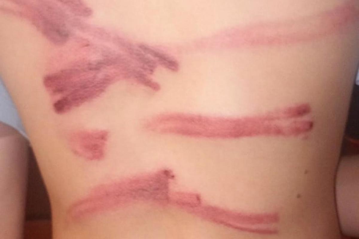 Pai é preso após agredir filho de 13 anos com mangueira em Bariri