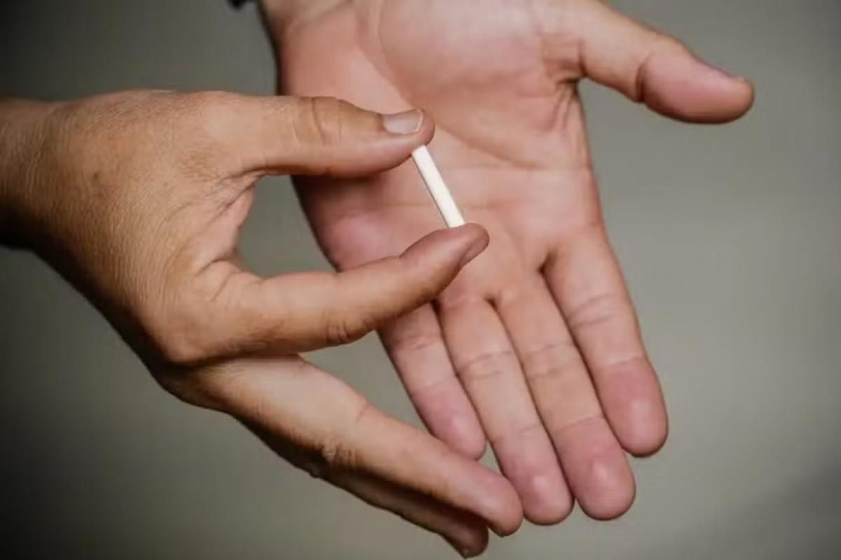 Entidades médicas pedem à Anvisa proibição de chips da beleza