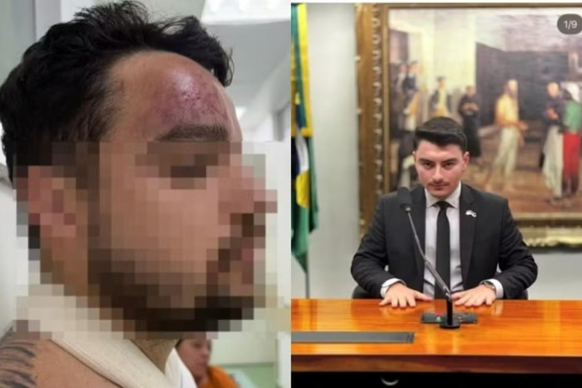 Polícia investiga assessor de Jair Renan após agredir primo